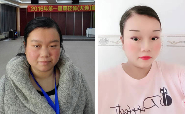 蔡红